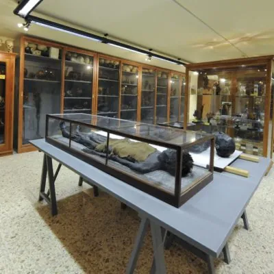 Museo di anatomia e istologia patologica